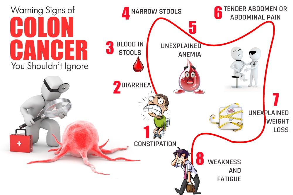 colon-cancer-rev.jpg