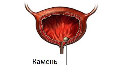 инородное тело.jpg инородное тело.jpg
