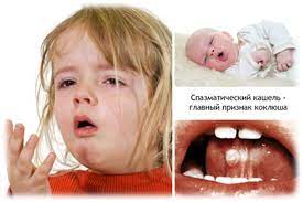 Лечение коклюша у детей в Пятигорске
