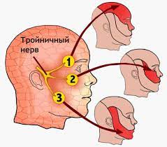 тройничный нерв, головная боль, анатомия инервации