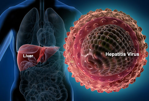 webmd_rf_photo_of_liver_and_hepatitis_virus.jpg